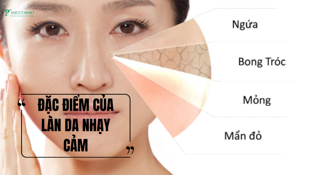 5 tiêu chí chọn sữa rửa mặt cho da nhạy cảm an toàn